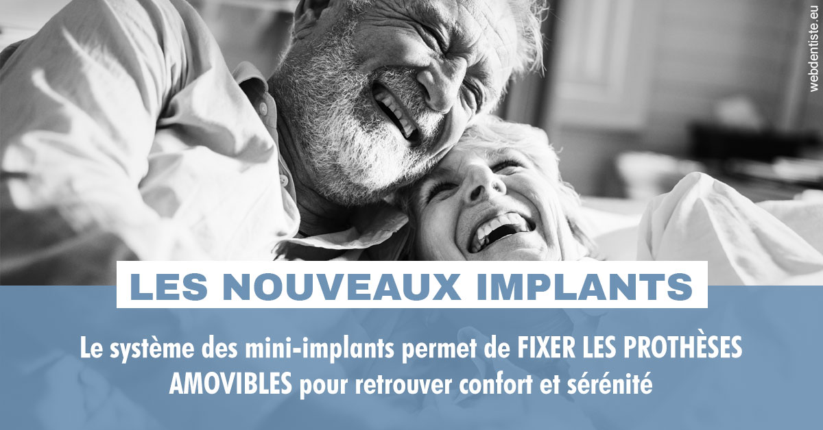 https://www.cabinetdentaireducentre.fr/Les nouveaux implants 2