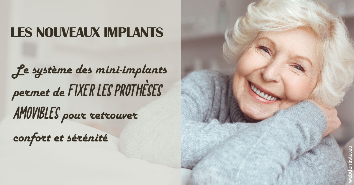 https://www.cabinetdentaireducentre.fr/Les nouveaux implants 1