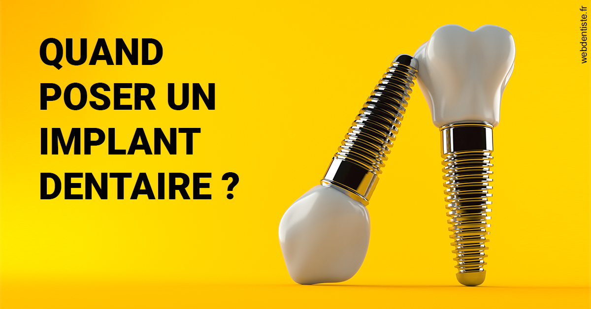 https://www.cabinetdentaireducentre.fr/Les implants 2