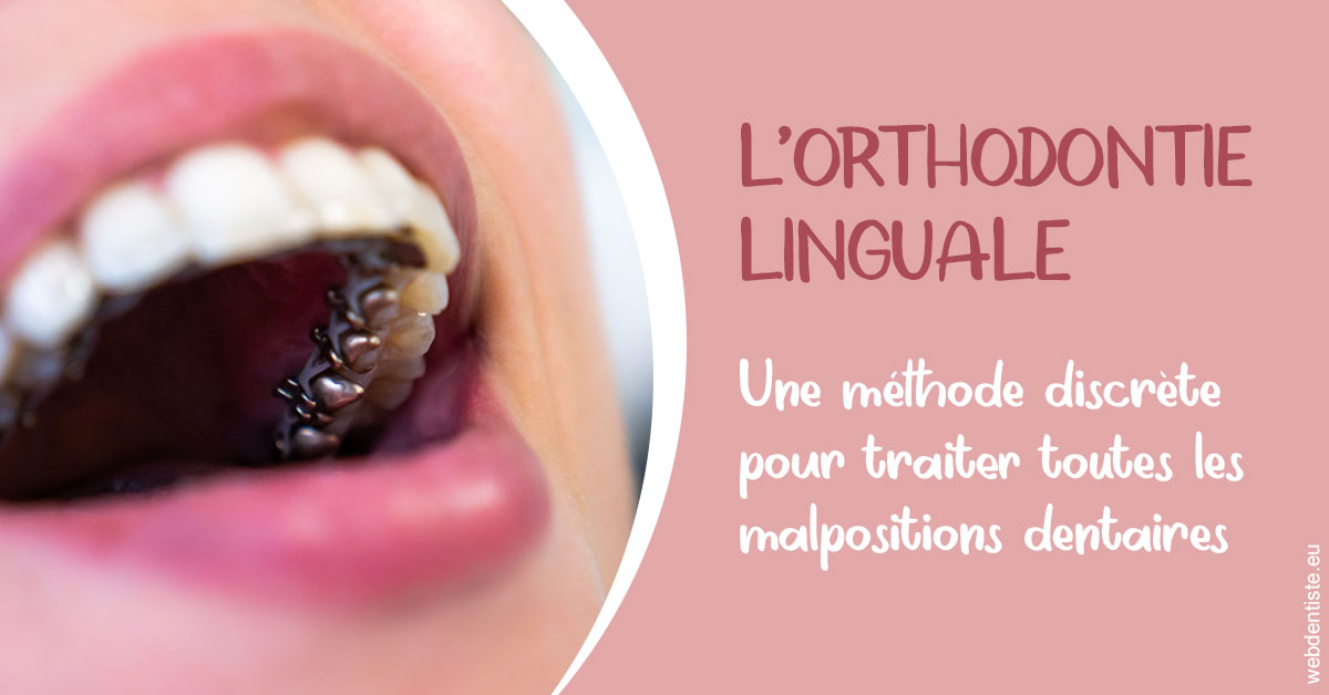https://www.cabinetdentaireducentre.fr/L'orthodontie linguale 2