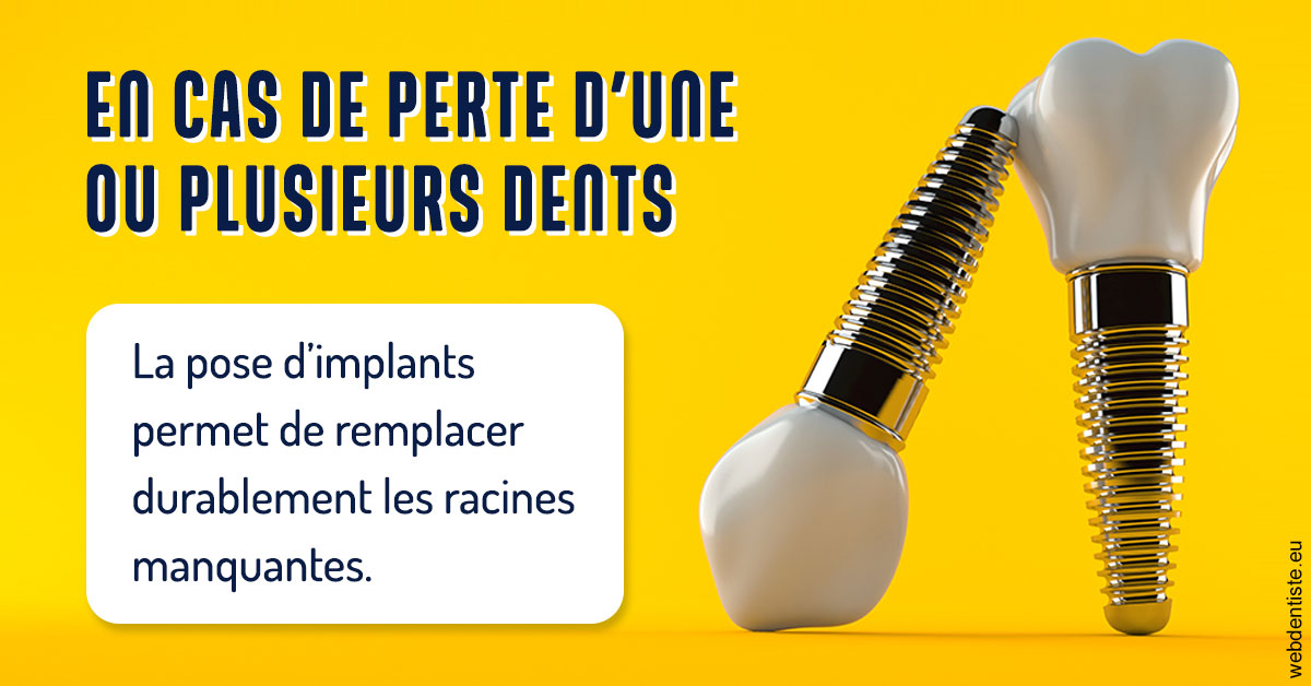 https://www.cabinetdentaireducentre.fr/2024 T1 - Implants 02