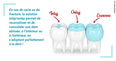 https://www.cabinetdentaireducentre.fr/L'INLAY ou l'ONLAY