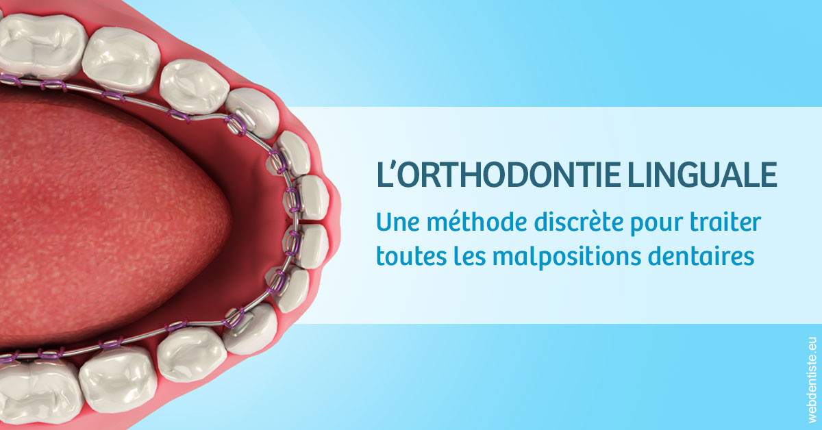 https://www.cabinetdentaireducentre.fr/L'orthodontie linguale 1