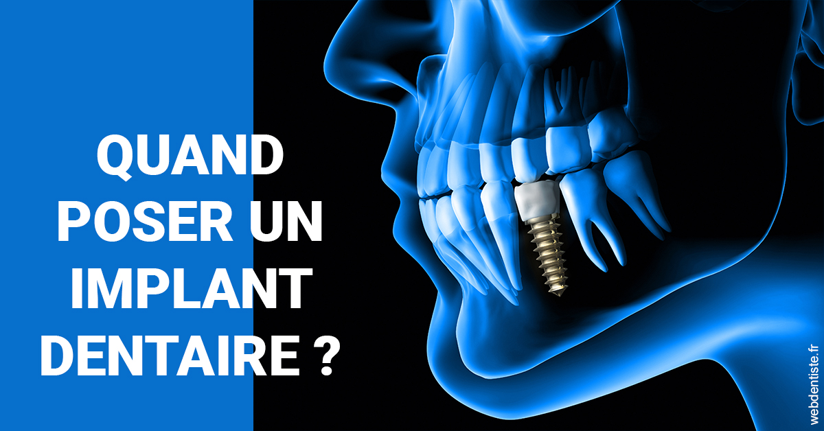 https://www.cabinetdentaireducentre.fr/Les implants 1