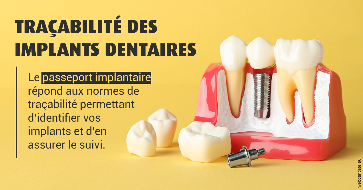 https://www.cabinetdentaireducentre.fr/T2 2023 - Traçabilité des implants 2