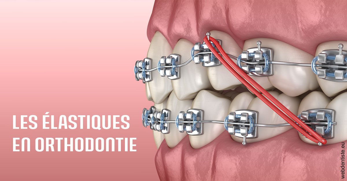 https://www.cabinetdentaireducentre.fr/Elastiques orthodontie 2