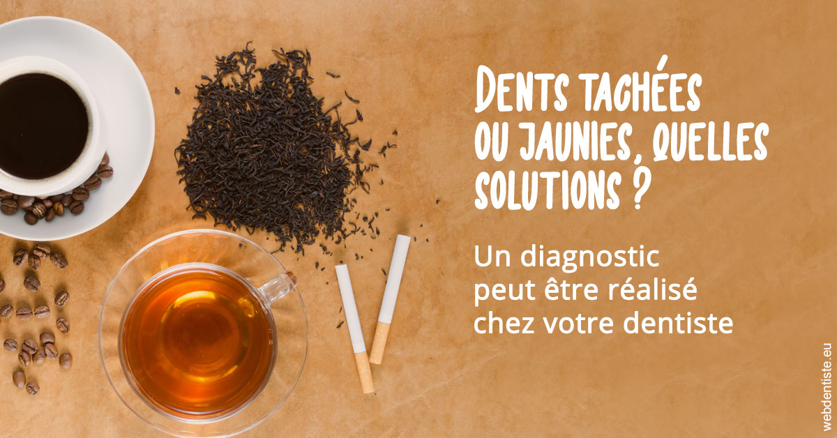 https://www.cabinetdentaireducentre.fr/Dents tachées 2